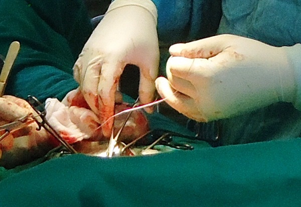 Chuẩn bị trước mổ và chăm sóc bệnh nhân sau mổ