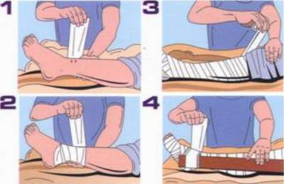Phác đố điều trị rắn cắn