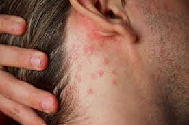 Đoán bệnh nội khoa qua làn da 
